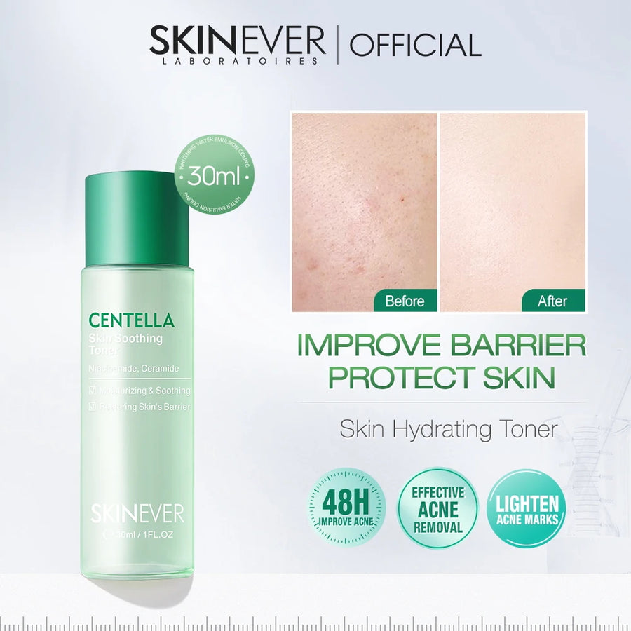 SKINEVER 3-Piece Acne Care & Hydration Set - Beauty Unstoppable Anti-Aging Skincare